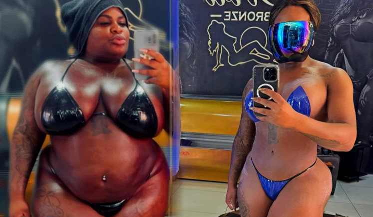“EU ME AMEI COM 146KG”: Jojo Todynho posta antes e depois de cirurgia bariátrica
