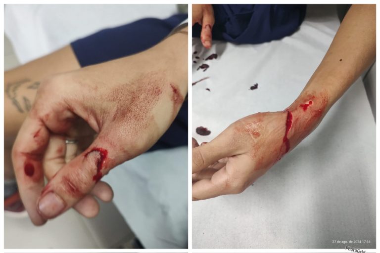 Passageiro do Metrô esfaqueado no acesso da estação de Pernambués por causa do bairro que mora; entenda
