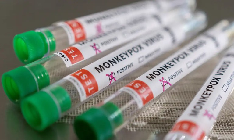 Congo tem mais de 18 mil casos e 615 mortes por mpox