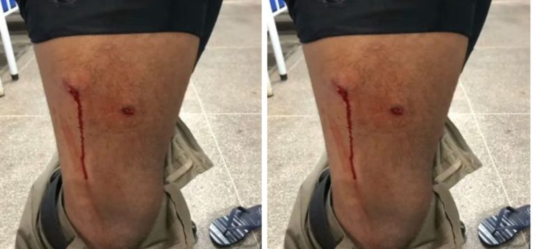 Policial militar baleado por traficantes na Avenida Suburbana