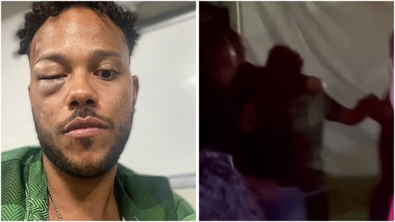 VIOLÊNCIA NO FV24: Homem é agredido brutalmente por seguranças de evento e teme perder a visão