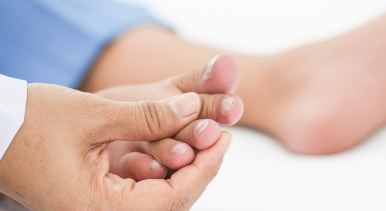 Câncer de pele nas unhas? Dermatologistas esclarecem e deixam mais avisos