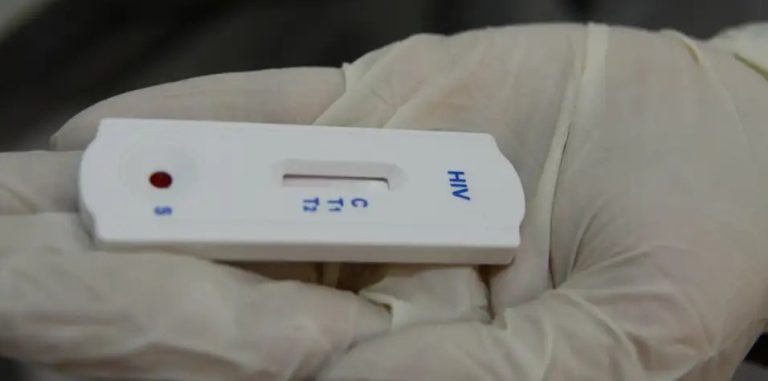Saúde orienta farmácias sobre testes para HIV, sífilis e hepatites
