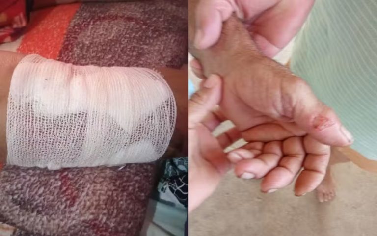 ITAGIMIRIM: Homem preso por agredir pai é suspeito de abusar de mãe idosa