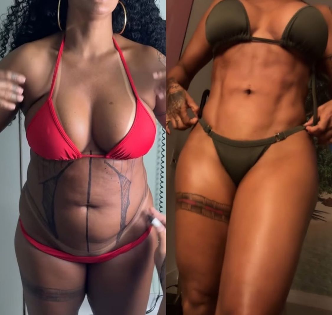 SEM FILTRO: Rosiane Pinheiro mostra antes e depois da lipoescultura HD: “ressurgindo das cinzas” 1 - SEM FILTRO: Rosiane Pinheiro mostra antes e depois da lipoescultura HD: “ressurgindo das cinzas”
