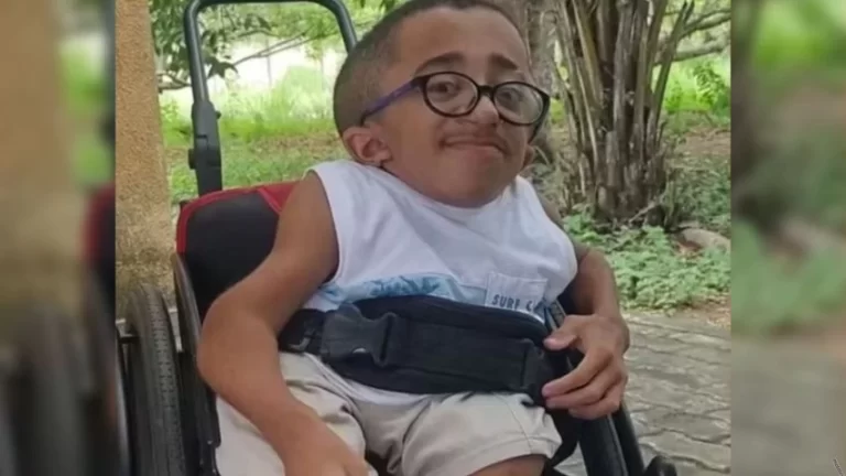 Adolescente conhecido por ter “ossos de vidro” morre aos 15 anos em Feira de Santana