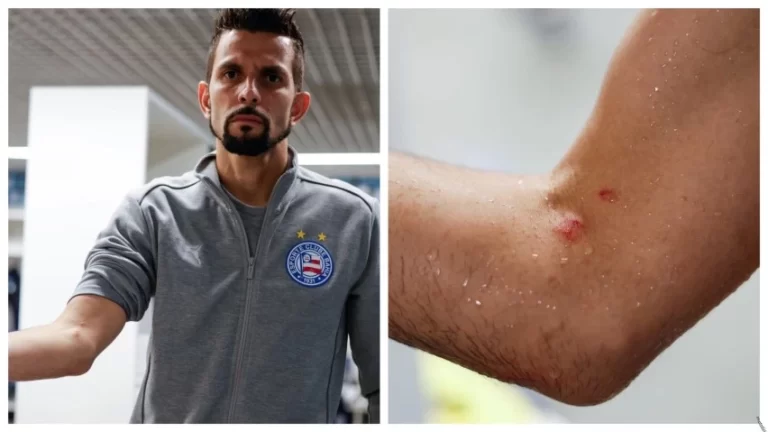 “EM VÃO”: Bahia questionou arbitragem que inventou pênalti para o Grêmio e aciona CBF