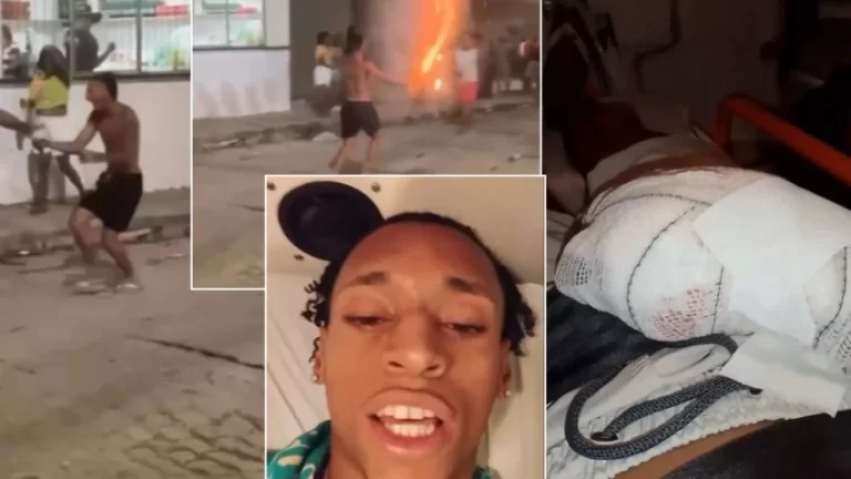 SUSTO: Jovem que teve espada explodida na mão precisou amputar dedo; veja o que ele disse após o acidente
