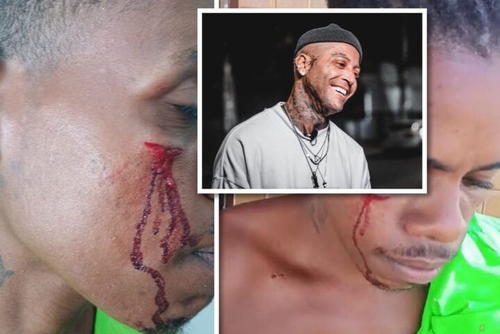 BOXE AFIADO: Kannário dá murro na cara de homem que teria olhado “maldosamente” sua filha