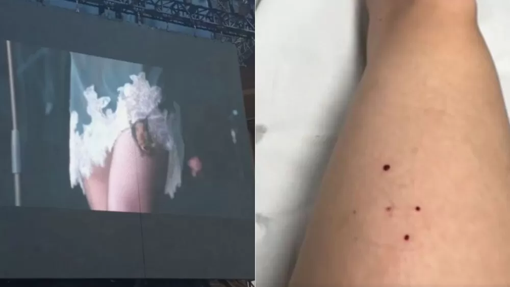 Cantora Taylor Momsen é mordida por morcego durante show