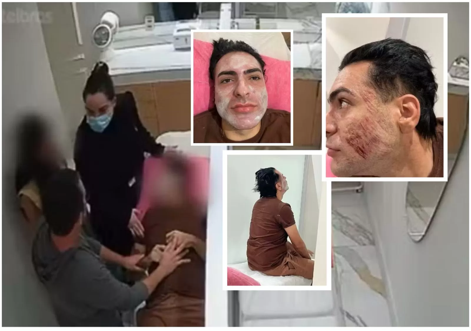 PEELING DE FENOL: MP denuncia influencer por homicídio de paciente durante procedimento