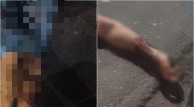 NA VIA PÚBLICA: Mototaxista é morto a tiros no Largo do Tanque